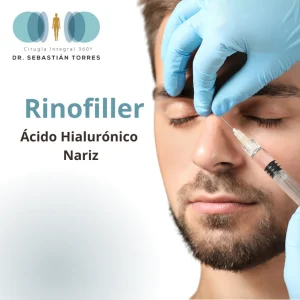Rinomodelación - acido hialurónico nariz